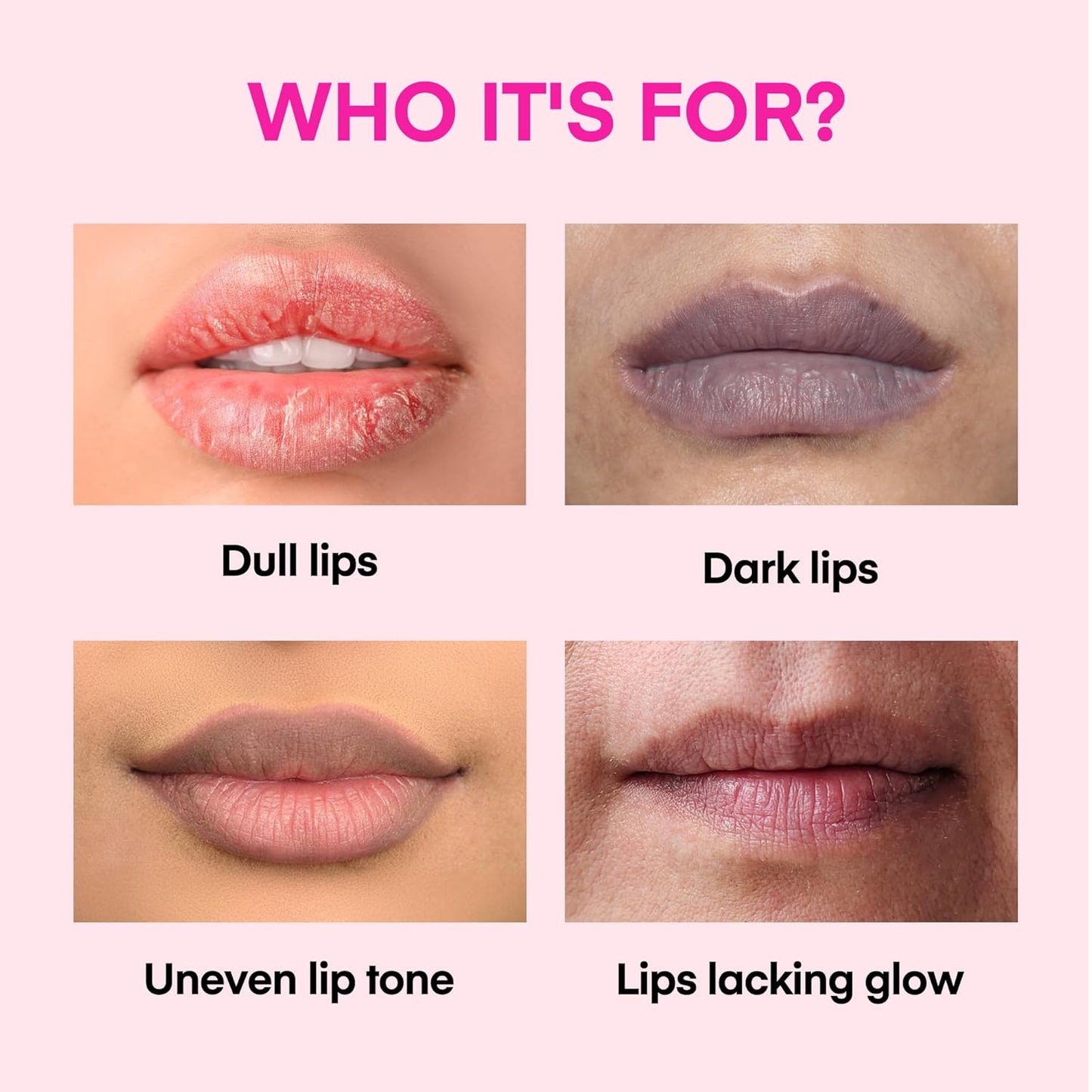 Kissbea Lip Lightening Gloss – Refreshing Mint – 15 ml